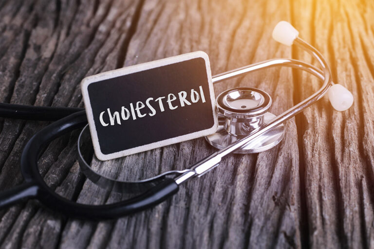 Colesterolo alto e alimentazione – L’esperto risponde