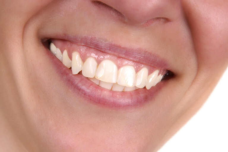 Estate e salute orale: anche i denti soffrono il caldo